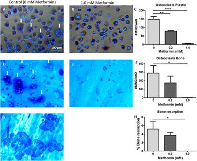 Diabetes Medication Metformin Inhibits Osteoclast Formation and Activity in In Vitro Models for Periodontitis